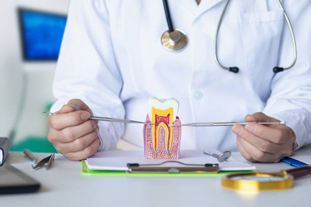 Best Emergency Root Canal Treatment in South Sarasota, FL